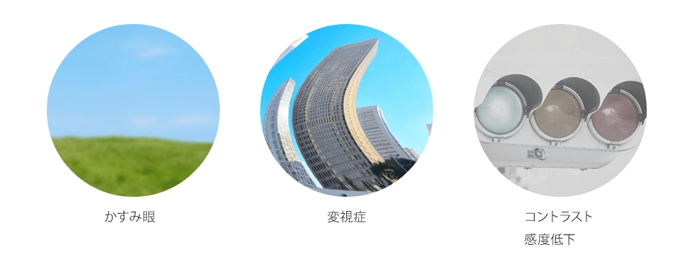 糖尿病黄斑浮腫とは？
